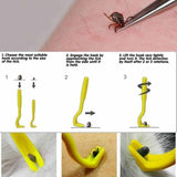 2Pcs Plastic Tick Twister Hook Flea Remover
